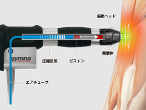 圧力波の原理の図