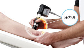 圧力波によるポイント刺激